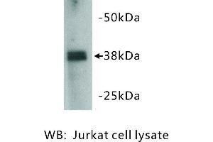 Image no. 1 for anti-Zinc Finger Protein 42 (ZFP42) antibody (ABIN1112835) (ZFP42 antibody)