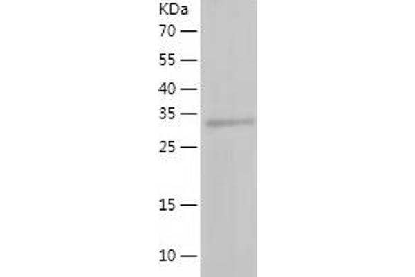 LRPAP1 Protein (AA 29-360) (His tag)