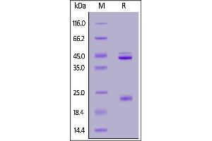 Human IL-23A & Rat IL-12B Heterodimer Protein, His Tag&Tag Free on  under reducing (R) condition. (IL12A & IL27B (AA 20-189) (Active) protein (His tag))