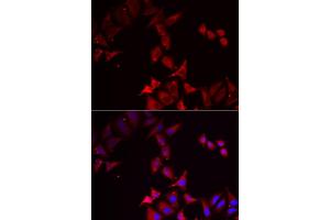 Immunofluorescence analysis of U2OS cells using PCBD1 antibody (ABIN5973794).