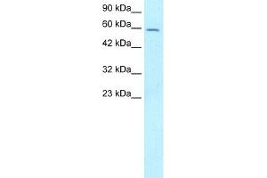 WB Suggested Anti-FOXG1A Antibody Titration:  5. (FOXG1 antibody  (N-Term))