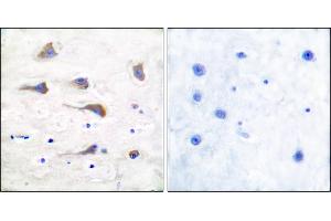 Immunohistochemical analysis of paraffin-embedded human brain tissue using GluR6 antibody. (Metabotropic Glutamate Receptor 6 antibody)
