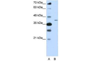 ZNF488 antibody used at 0. (ZNF488 antibody  (N-Term))