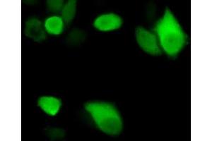 Detection of ENO3 in Hela cells using Polyclonal Antibody to Enolase 3 (ENO3) (ENO3 antibody  (AA 1-391))