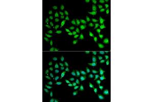 Immunofluorescence analysis of U2OS cells using UCN2 antibody (ABIN5973879). (Urocortin 2 antibody)