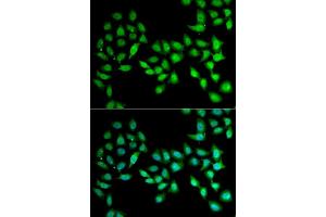 Immunofluorescence analysis of U2OS cells using UCN2 antibody (ABIN5973879).