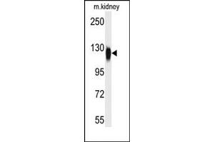 Image no. 1 for anti-Histone Deacetylase 6 (HDAC6) (C-Term) antibody (ABIN356649) (HDAC6 antibody  (C-Term))
