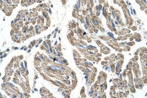 Image no. 1 for anti-Solute Carrier Family 25, Member 38 (SLC25A38) (AA 101-150) antibody (ABIN6736660) (SLC25A38 antibody  (AA 101-150))