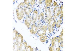 Immunohistochemistry (IHC) image for anti-BCL2/adenovirus E1B 19kDa Interacting Protein 3-Like (BNIP3L) antibody (ABIN1980299)