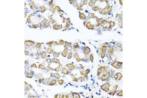 Immunohistochemistry of paraffin-embedded human stomach using SHMT1 antibody. (SHMT1 antibody  (AA 285-444))