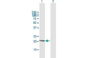 Western Blot analysis of DUSP18 expression in transfected 293T cell line by DUSP18 MaxPab polyclonal antibody. (DUSP18 antibody  (AA 1-188))