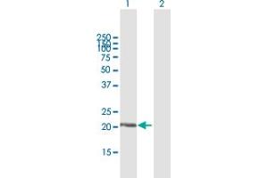 Western Blot analysis of DUSP18 expression in transfected 293T cell line by DUSP18 MaxPab polyclonal antibody. (DUSP18 antibody  (AA 1-188))