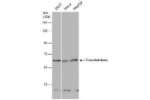 Western Blotting (WB) image for anti-Transketolase (TKT) antibody (ABIN2855058)