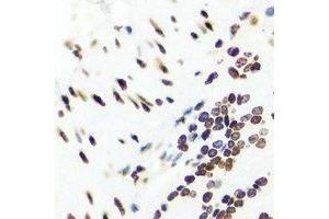 Immunohistochemistry (IHC) image for anti-Purinergic Receptor P2X, Ligand-Gated Ion Channel, 5 (P2RX5) antibody (ABIN7308100) (P2RX5 antibody)