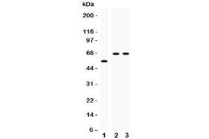 Western blot testing of CYP2E1 antibody and Lane 1:  rat liver;  2: human HeLa;  3: (h) Jurkat;  Observed size: 56-65KD