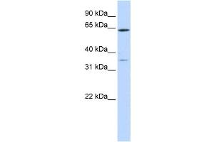 Western Blotting (WB) image for anti-Tripartite Motif Containing 45 (TRIM45) antibody (ABIN2458737)