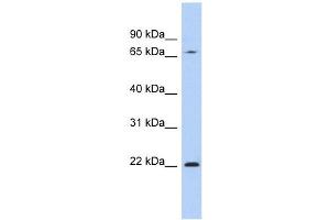 RPS7 antibody used at 1 ug/ml to detect target protein. (RPS7 antibody  (N-Term))