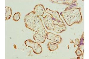 Immunohistochemistry of paraffin-embedded human placenta tissue using ABIN7146547 at dilution of 1:100 (Calpain 6 antibody  (AA 195-494))