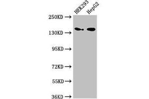 Western Blot Positive WB detected in: HEK293 whole cell lysate, HepG2 whole cell lysate All lanes: MAN2A1 antibody at 3. (alpha-Mannosidase II antibody  (AA 31-181))