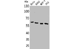 Western Blot analysis of HeLa K562 MCF7 PC-3 cells using p63 Polyclonal Antibody (p63 antibody  (N-Term))