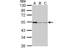 WB Image Cyclin A2 antibody detects CCNA2 protein by Western blot analysis. (Cyclin A antibody)