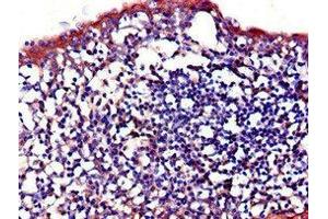 Immunohistochemistry of paraffin-embedded human tonsil tissue using ABIN7156864 at dilution of 1:100 (IL23R antibody  (AA 15-125))