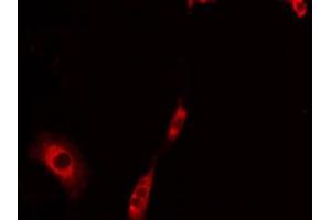 ABIN6275237 staining LOVO by IF/ICC. (MRPS30 antibody  (C-Term))