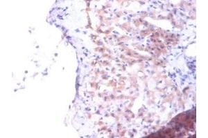 Immunohistochemistry of paraffin-embedded human liver tissue using ABIN7163250 at dilution of 1:100 (PTDSS1 antibody  (AA 1-35))