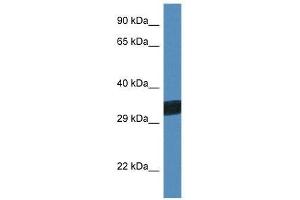 Western Blot showing Thap11 antibody used at a concentration of 1.