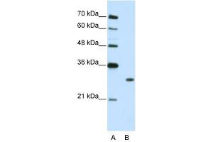 WB Suggested Anti-MBNL1 Antibody Titration:  2. (MBNL1 antibody  (C-Term))