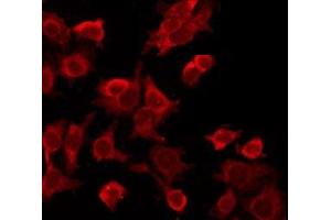 ABIN6277536 staining HeLa by IF/ICC. (LTBR antibody  (N-Term))