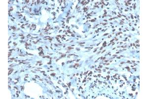 Immunohistochemistry (IHC) image for anti-Paired Box Gene 2a (PAX2A) (AA 223-354) antibody (ABIN6940252)