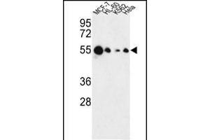 Western blot analysis of AIM2 Antibody (N-term) (ABIN653833 and ABIN2843099) in MCF-7, HL-60, K562, Hela cell line lysates (35 μg/lane).