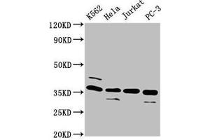 Western Blot Positive WB detected in: K562 whole cell lysate, Hela whole cell lysate, Jurkat whole cell lysate, PC-3 whole cell lysate All lanes: ATG3 antibody at 4 μg/mL Secondary Goat polyclonal to rabbit IgG at 1/50000 dilution Predicted band size: 36 kDa Observed band size: 36 kDa (ATG3 antibody  (AA 1-314))