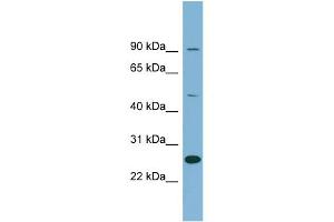 WB Suggested Anti-LRRC49 Antibody Titration: 0. (LRRC49 antibody  (N-Term))