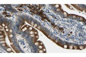 ABIN6276238 at 1/100 staining Mouse intestine tissue by IHC-P. (GIPR antibody  (Internal Region))