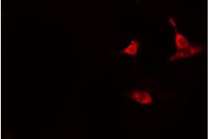 ABIN6274112 staining HeLa cells by IF/ICC. (BUB1B antibody  (C-Term))
