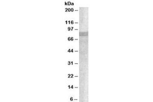 Western blot testing of A549 lysate with SNX18 antibody at 1ug/ml. (SNX18 antibody)