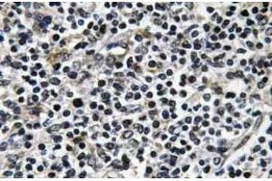 Immunohistochemistry (IHC) analyzes of p-ZAP-70 antibody in paraffin-embedded human thymus gland tissue. (ZAP70 antibody  (pTyr319))