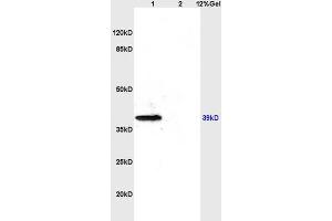 L1 rat brain lysates L2 rat kidney lysates probed with Anti- CD184/CXCR4 Polyclonal Antibody, Unconjugated (ABIN730888) at 1:200 overnight at 4 °C. (CXCR4 antibody  (AA 201-294))