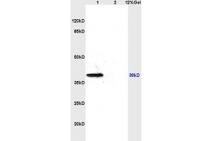 L1 rat brain lysates L2 rat kidney lysates probed with Anti- CD184/CXCR4 Polyclonal Antibody, Unconjugated (ABIN730888) at 1:200 overnight at 4 °C. (CXCR4 antibody  (AA 201-294))