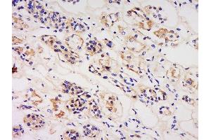 Paraformaldehyde-fixed, paraffin embedded human kidney, Antigen retrieval by boiling in sodium citrate buffer (pH6) for 15min, Block endogenous peroxidase by 3% hydrogen peroxide for 30 minutes, Blocking buffer (normal goat serum) at 37°C for 20min, Antibody incubation with 	Rabbit Anti-IL-3R alpha/CD123 Polyclonal Antibody, Unconjugated  at 1:200 overnight at 4°C, followed by a conjugated secondary and DAB staining. (IL3RA antibody  (AA 201-300))