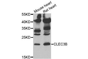 Western blot analysis of extracts of mouse heart and rat heart tissues, using CLEC3B antibody. (CLEC3B antibody)