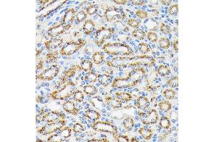 Immunohistochemistry of paraffin-embedded mouse kidney using NDUFS4 Rabbit mAb (ABIN7268821) at dilution of 1:100 (40x lens). (NDUFS4 antibody)