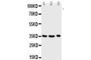 Anti-Granzyme A antibody, Western blotting Lane 1: JURKAT Cell Lysate Lane 2: CEM Cell Lysate Lane 3: RAJI Cell Lysate (GZMA antibody  (Middle Region))