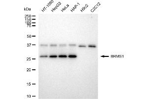 Western blotting analysis using BRMS1 antibody (ABIN7797793).