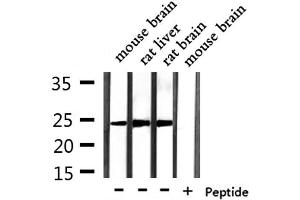 Western blot analysis of extracts from mouse brain,mouse liver,rat brain, using RAB15 Antibody. (RAB15 antibody  (Internal Region))