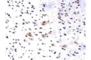 Formalin-fixed and paraffin embedded rat hippocampus labeled with Anti WIF1 Polyclonal Antibody, Unconjugated (ABIN751108) followed by conjugation to the secondary antibody and DAB staining (WIF1 antibody  (AA 51-150))