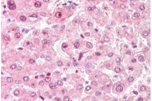 Human Liver: Formalin-Fixed, Paraffin-Embedded (FFPE) (COMT antibody  (C-Term))