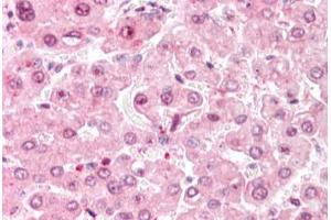 Human Liver: Formalin-Fixed, Paraffin-Embedded (FFPE) (COMT antibody  (C-Term))